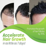 7X Rapid Growth Hair Treatment